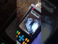 পোর্টেবল ভেটেরিনারি আল্ট্রাসাউন্ড স্ক্যানার BR-VET7