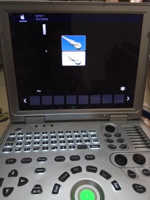 2D Portable color doppler machine