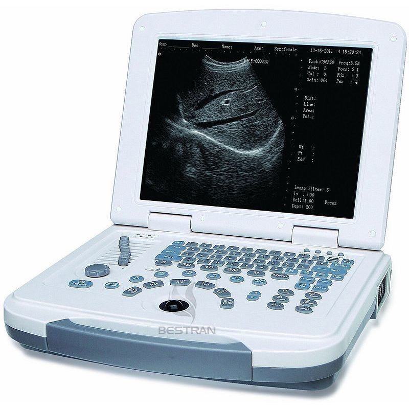 Laptop Ultrasound Scanner