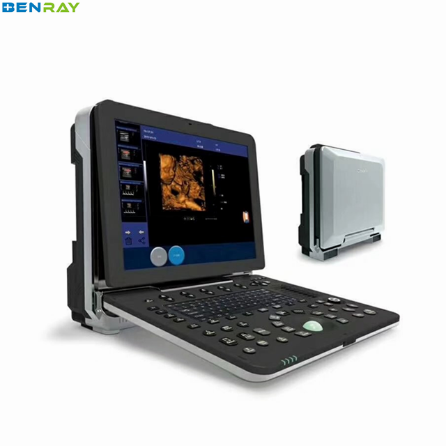 Medical Ultrasound Device 4D Portable Color Doppler Machine